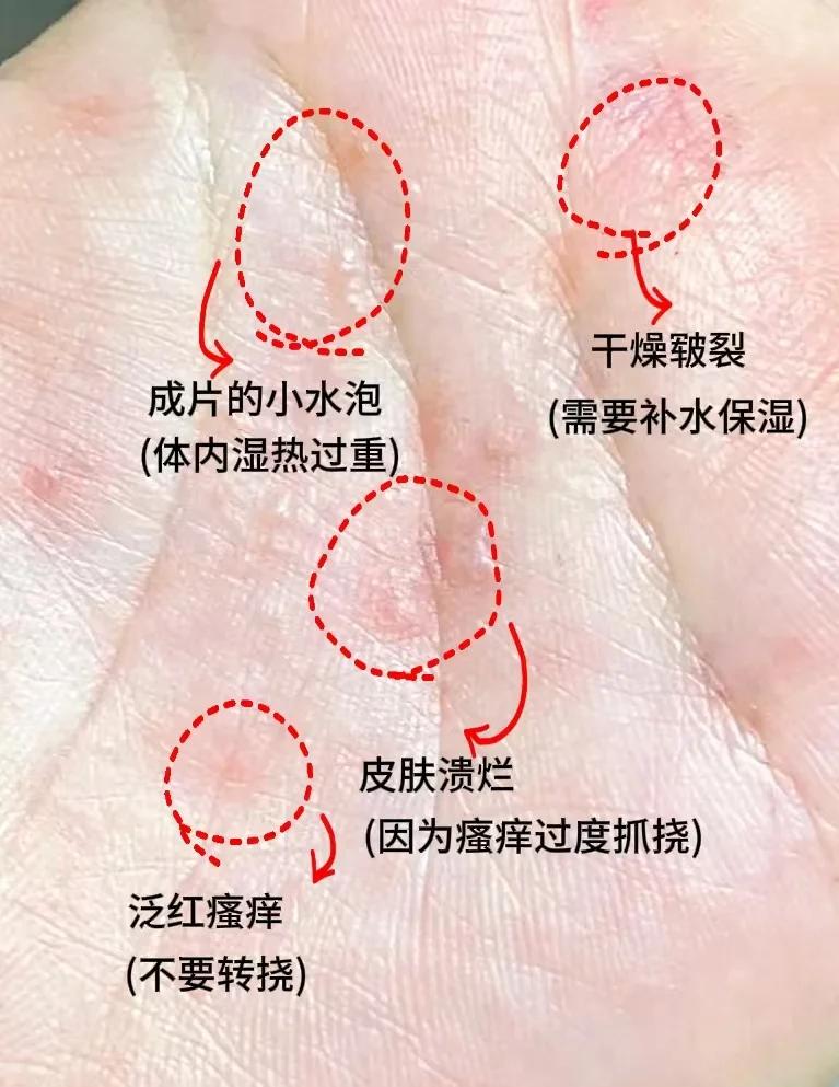 手指上长了小疙瘩什么原因