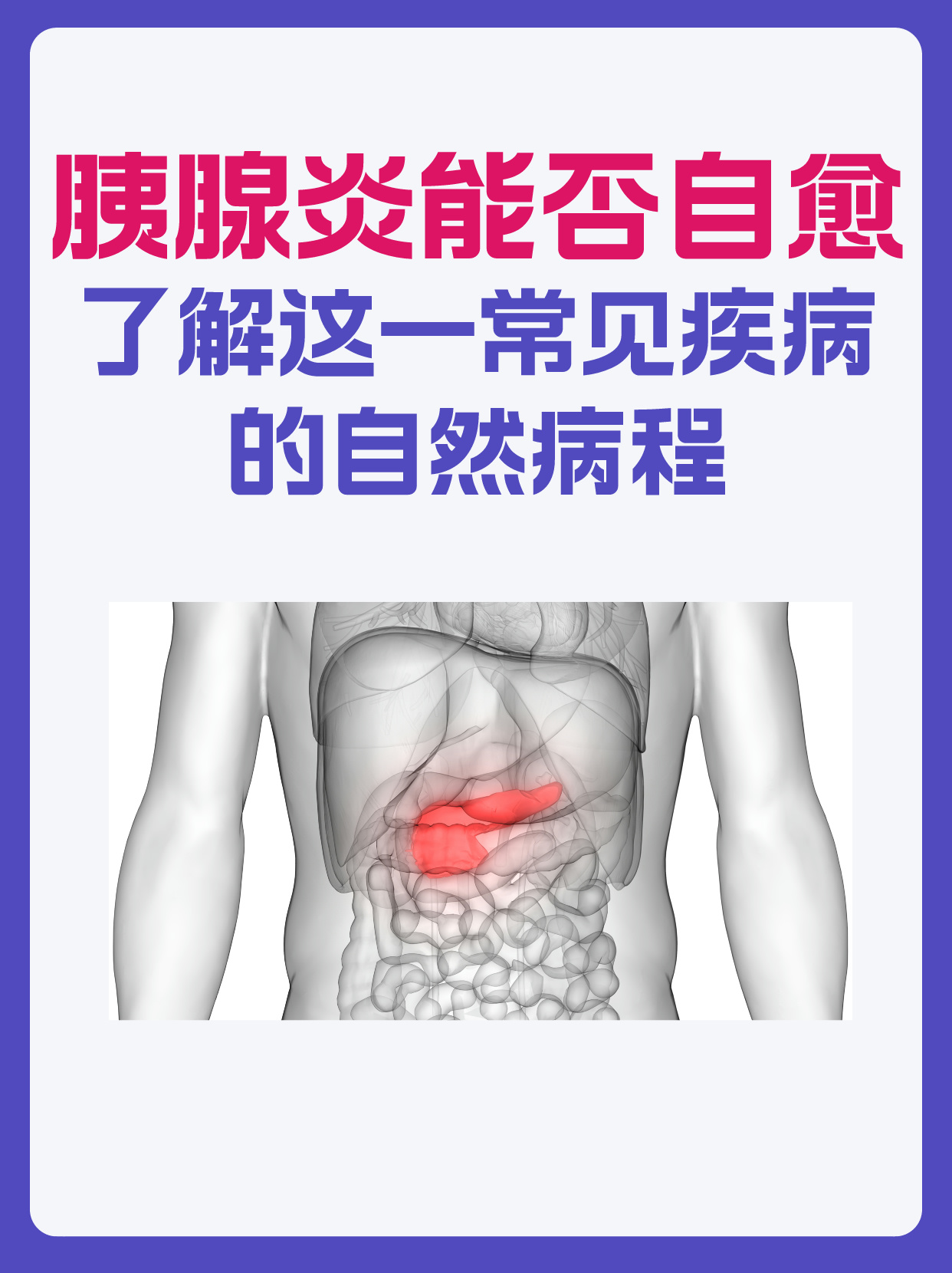 胰腺炎的症状严重吗