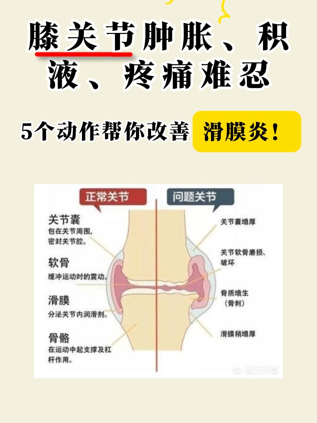 患者膝盖积水是什么症状