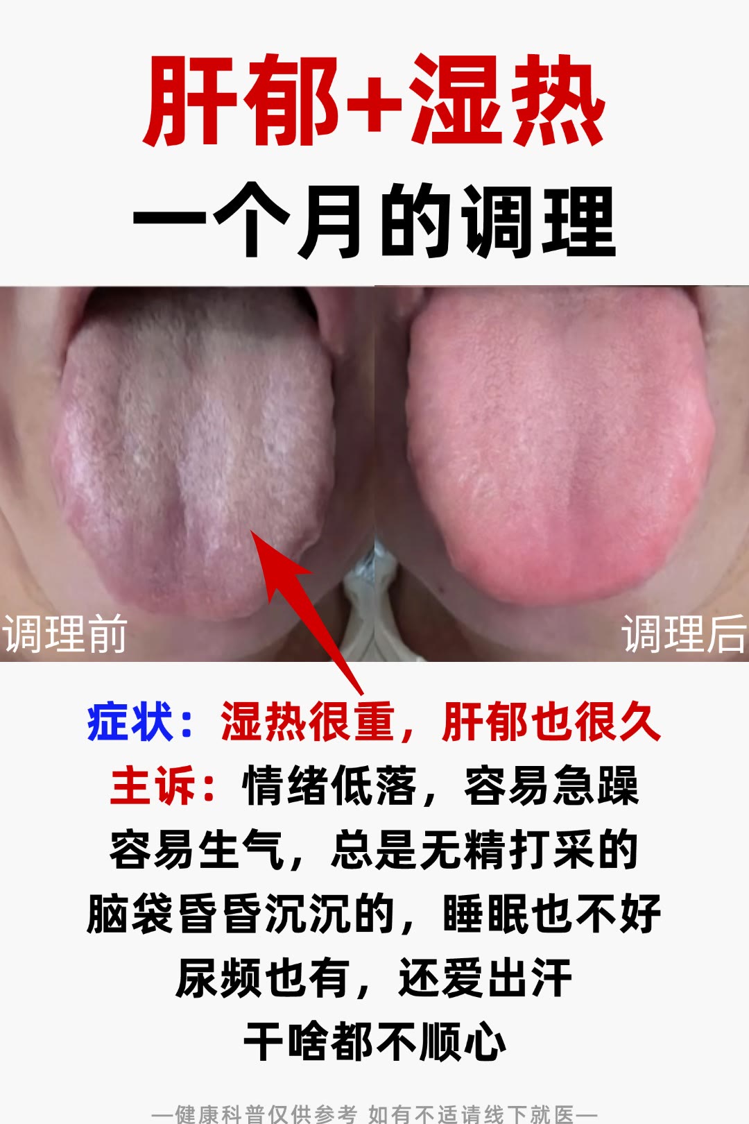 舌苔泛黄怎么回事