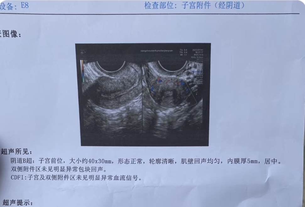 人流后没有血正常吗?