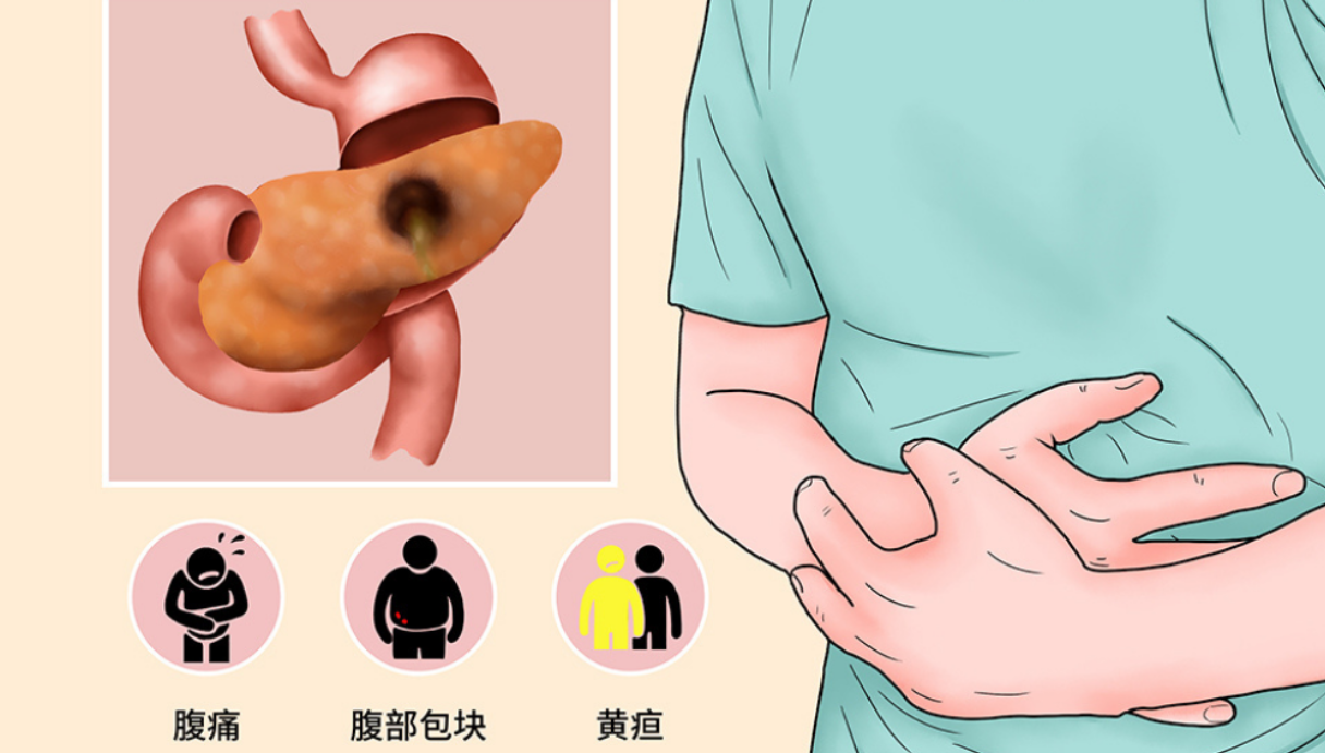 慢性胰腺炎症状有哪些