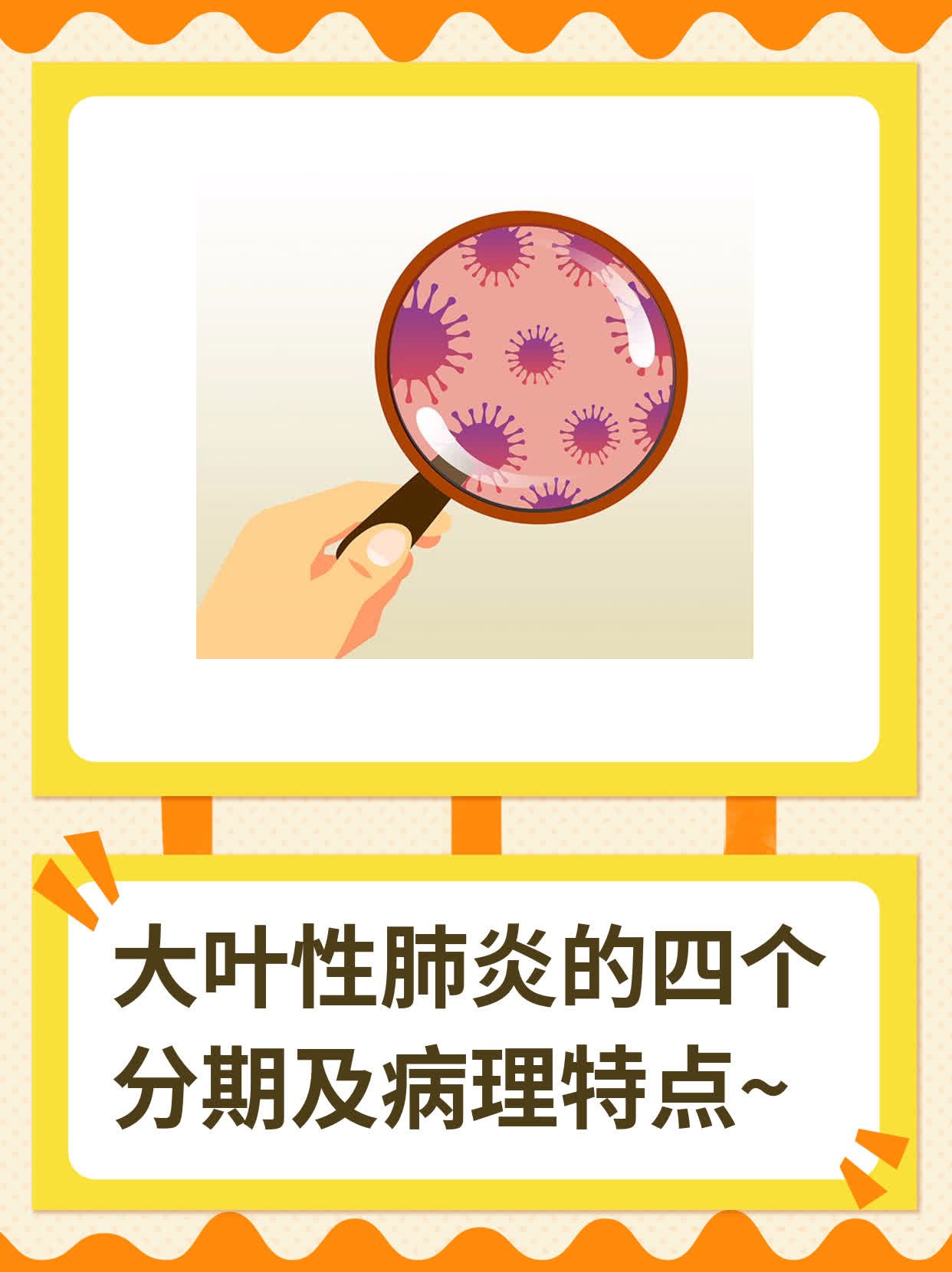 大叶性肺炎的治疗周期..