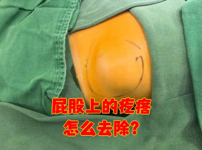 屁股上有硬块是怎么回事