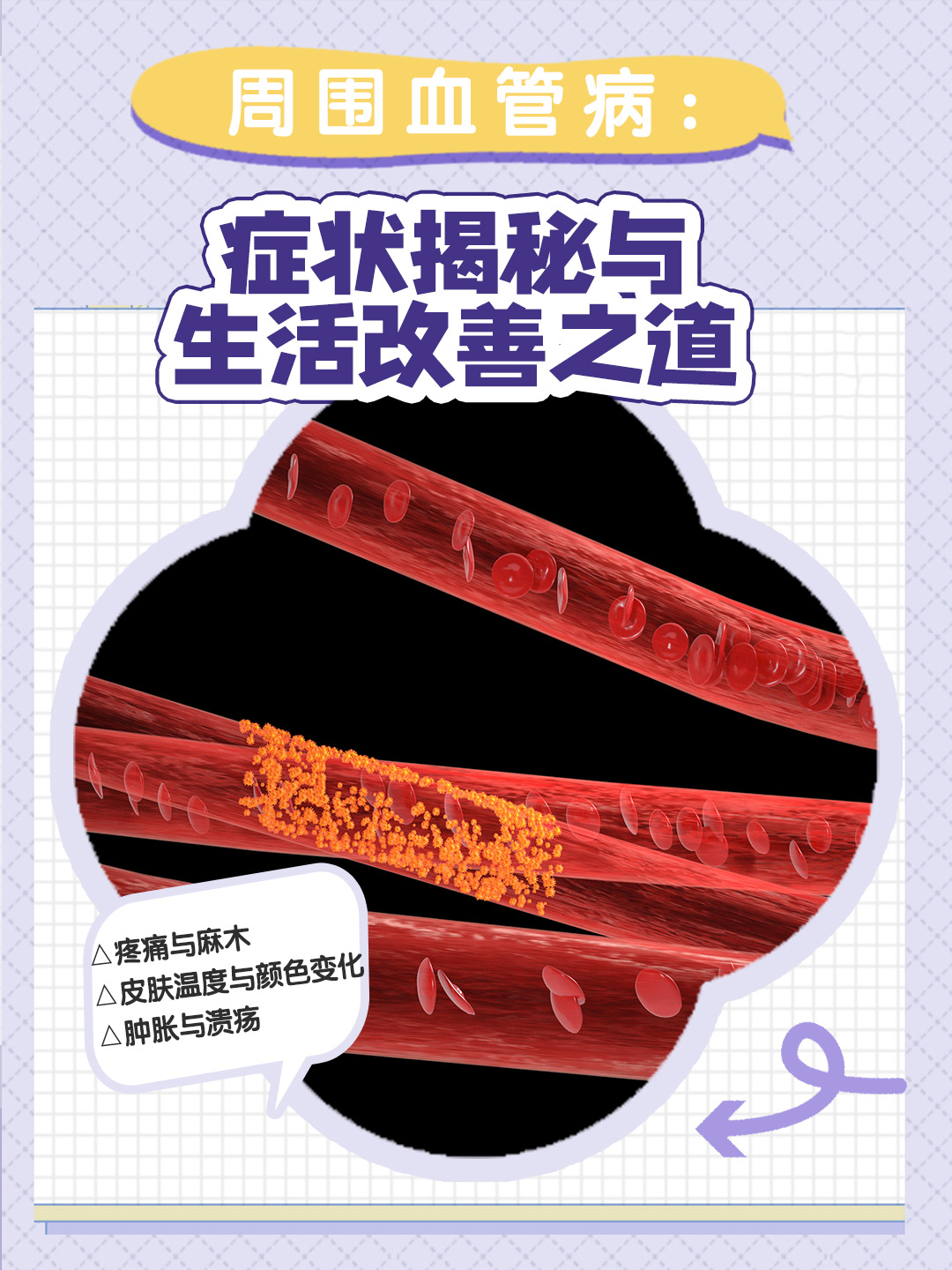 血管炎有生命危险吗