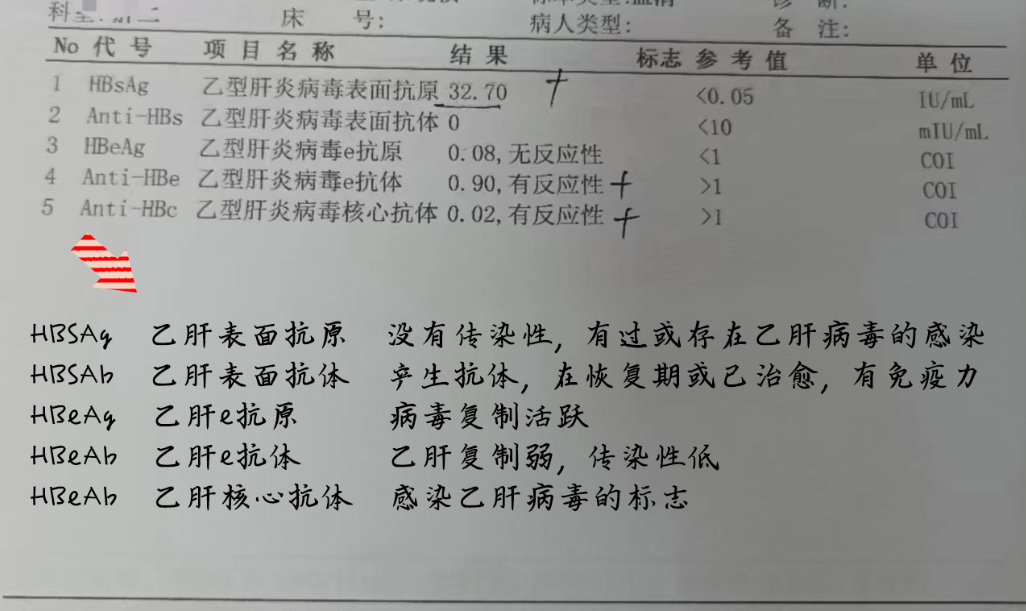 乙肝核心抗体偏高什么意思