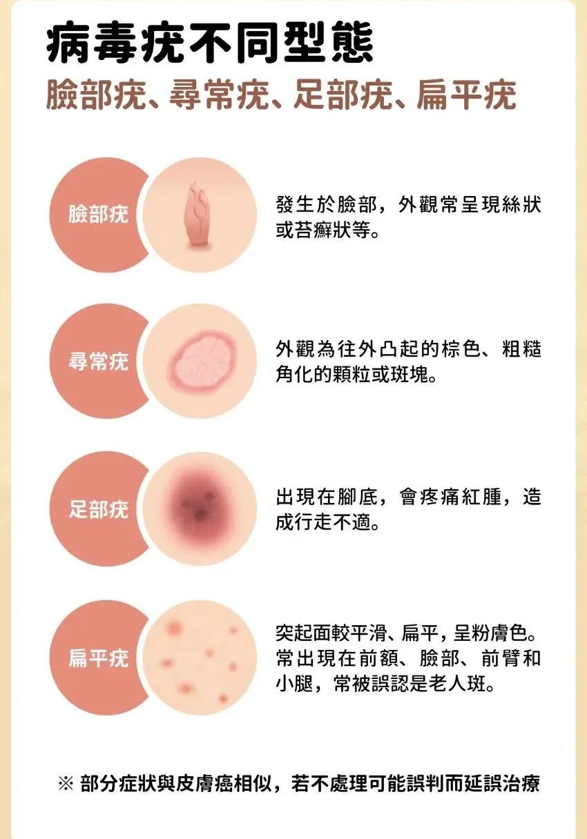 高危后几周出现的症状