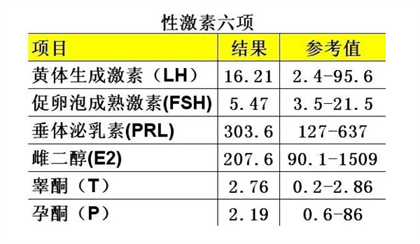 内分泌异常的检查项目有哪些