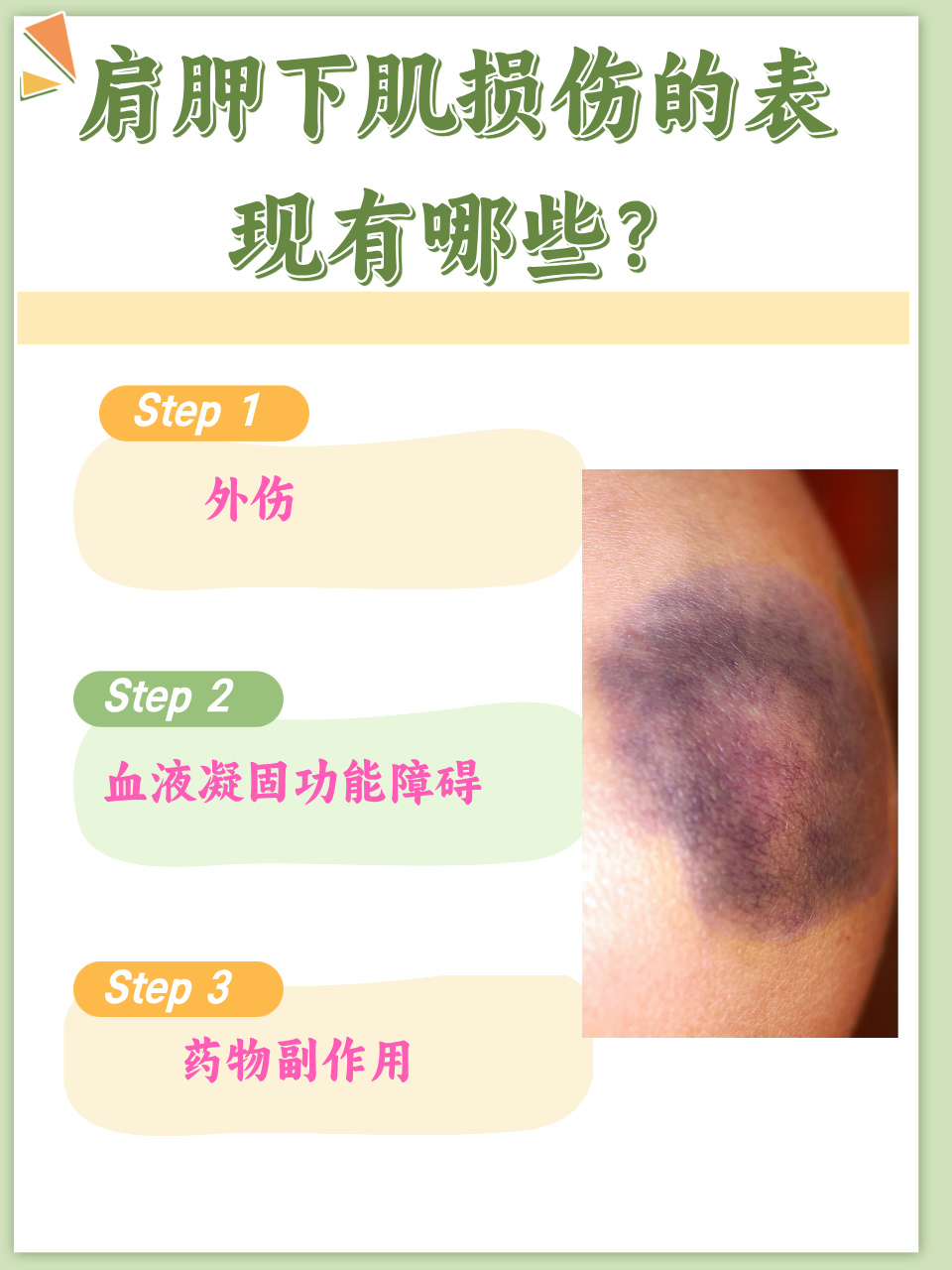 腿上受伤淤青怎么消除