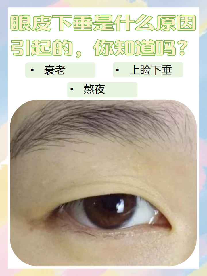 眼皮松弛,下垂怎么办