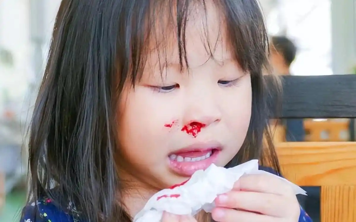 白血病流鼻血是一侧吗