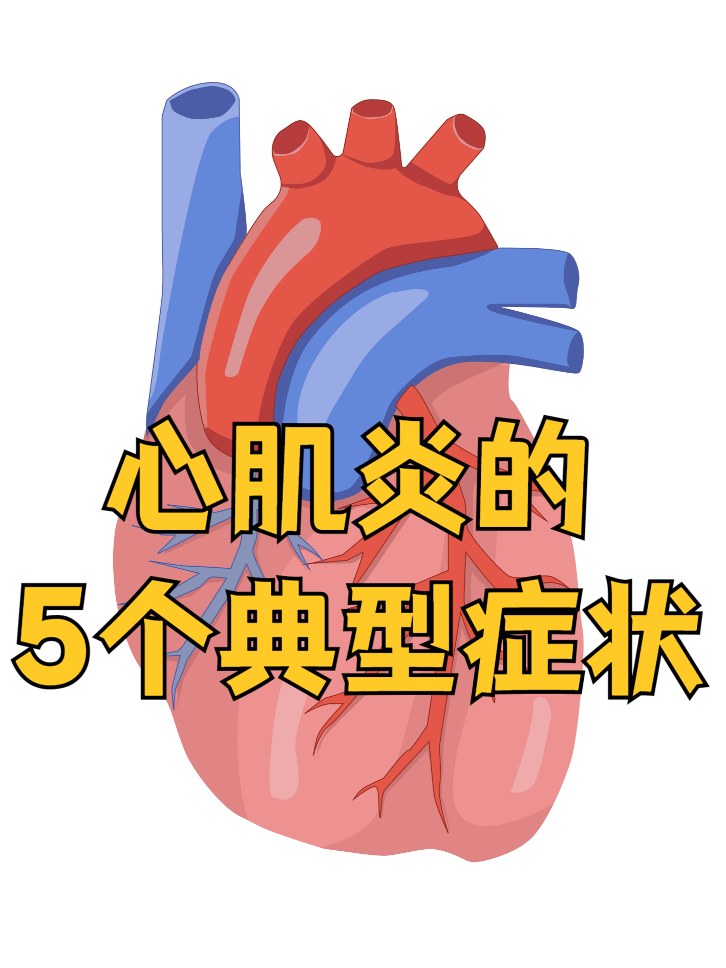 什么是心肌劳损?