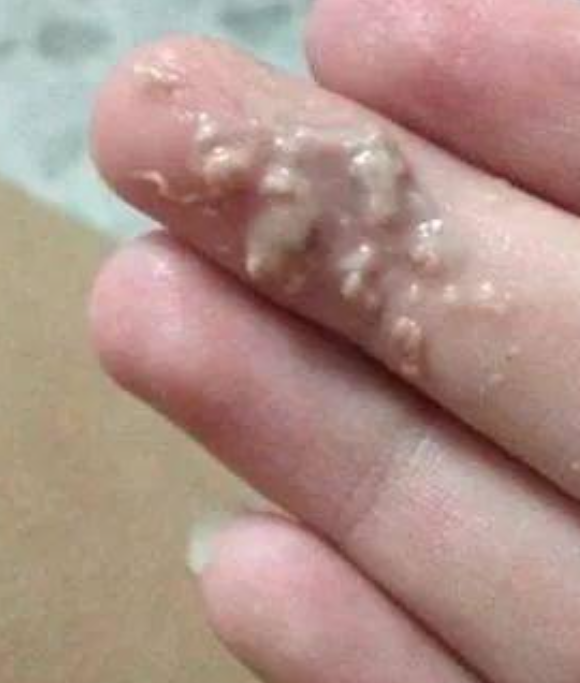 白带白色糊状怎么办