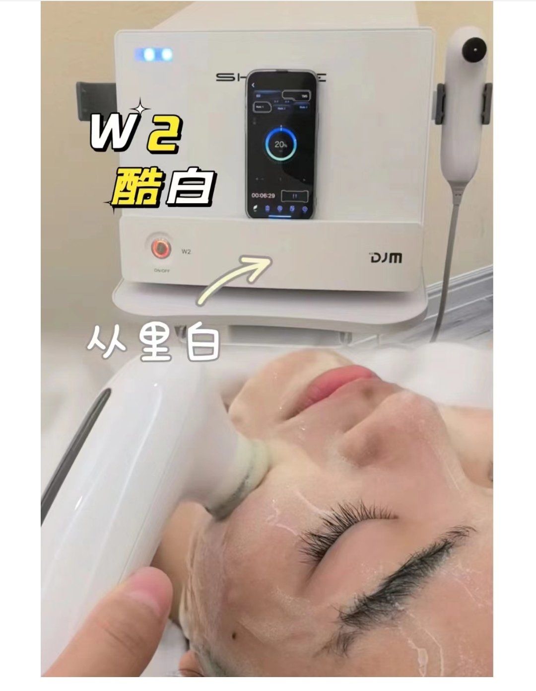 激光美白是什么?