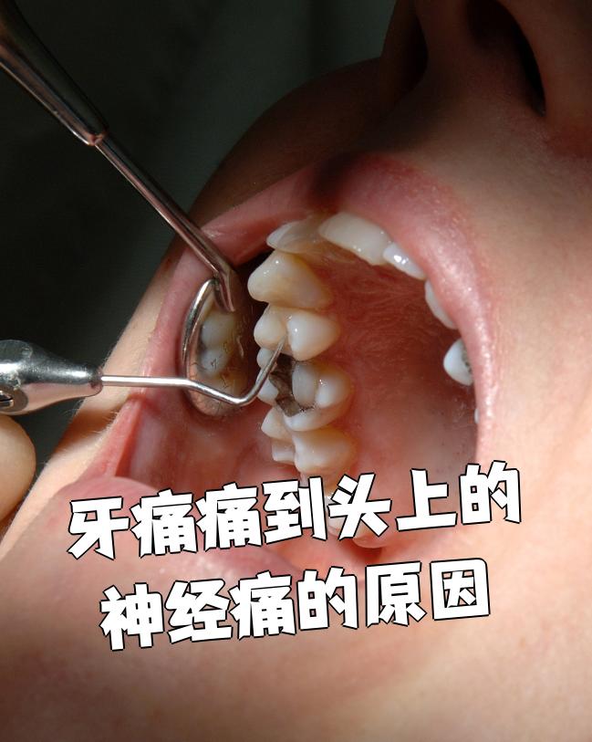 牙髓炎的症状有哪些?