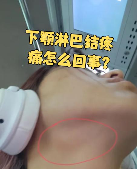 淋巴结发炎的症状