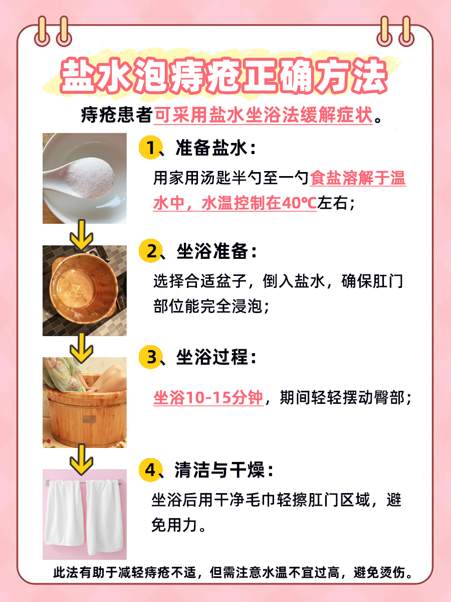 内痔要怎么治疗