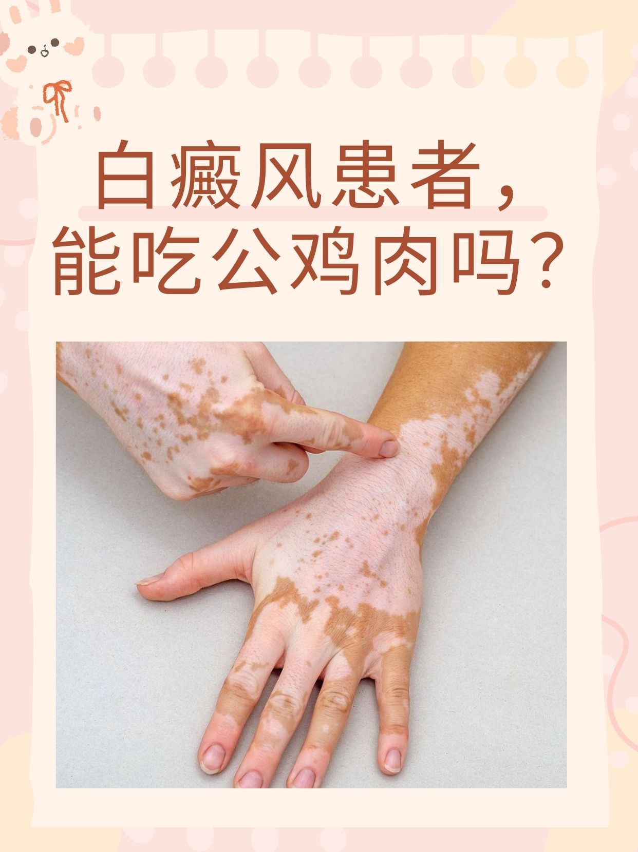 白癜风吃什么恢复快