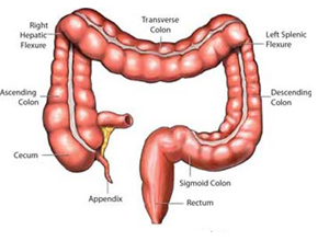 溃疡性结肠炎伴中毒性巨结肠