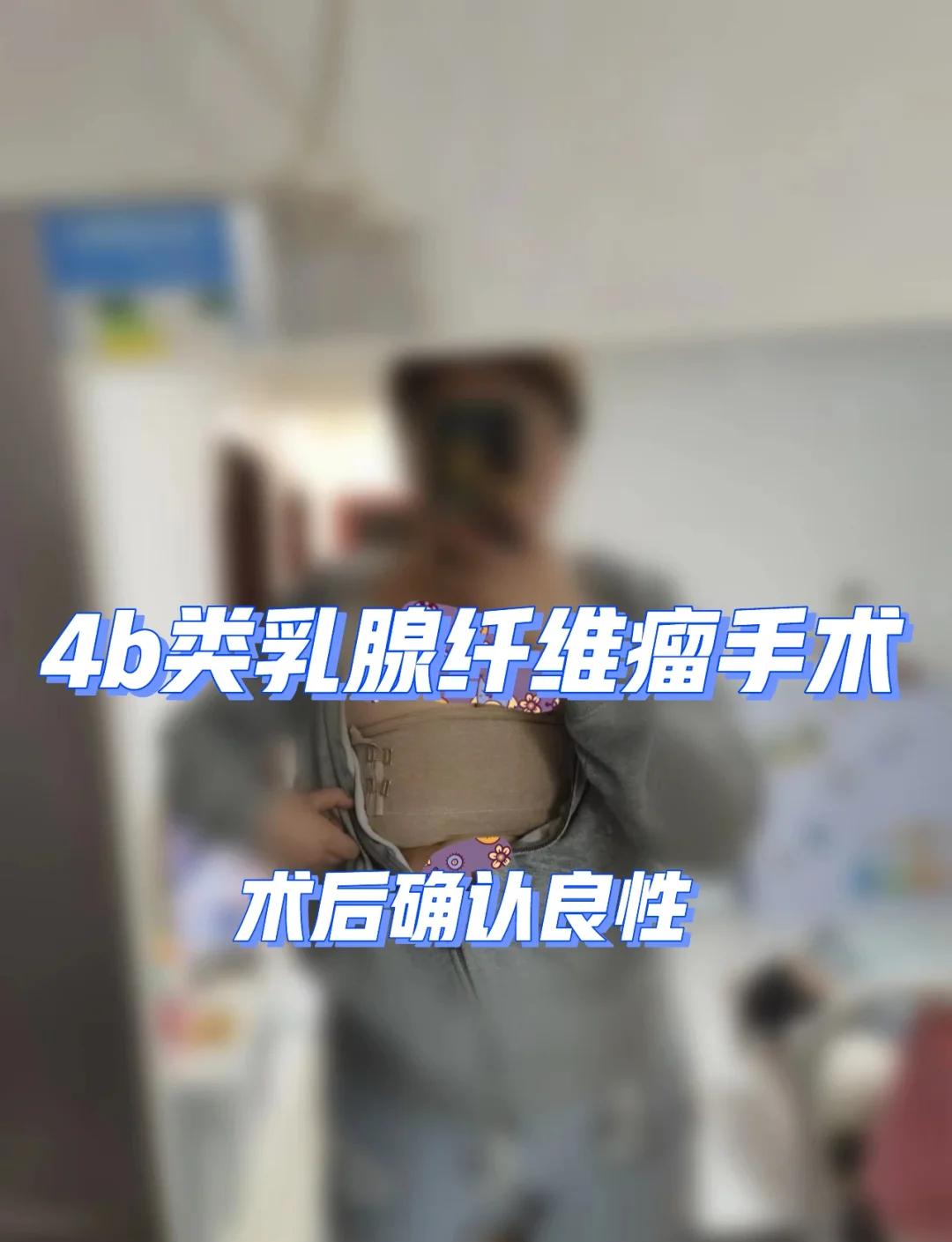 乳腺纤维瘤手术费多少