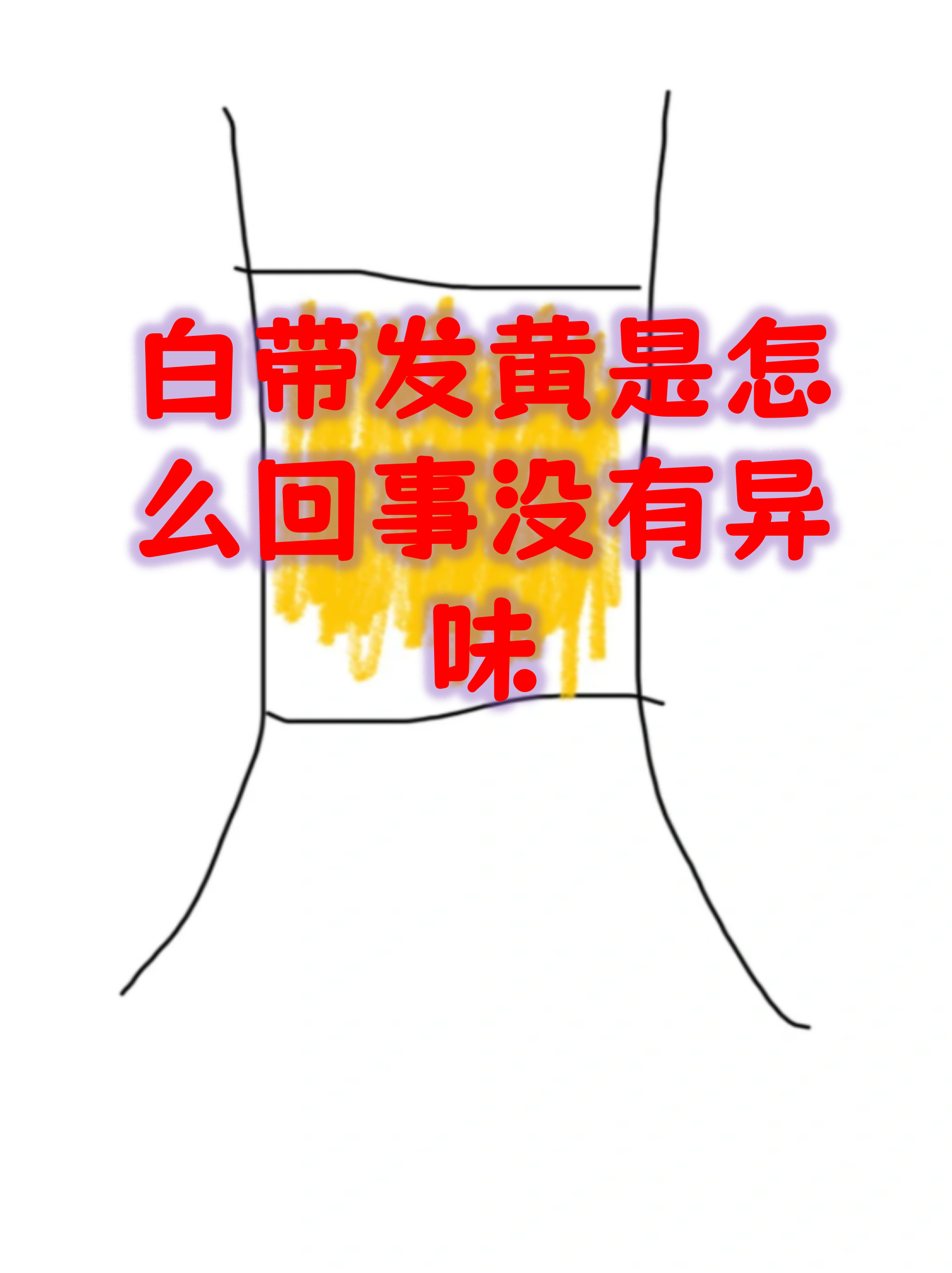 白带多,不来月经怎么回事