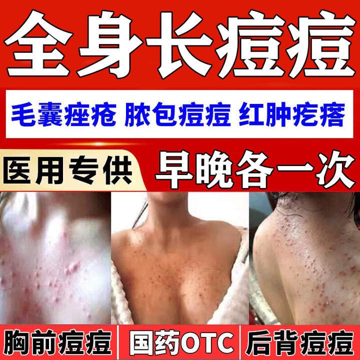 脸部毛囊炎怎么办