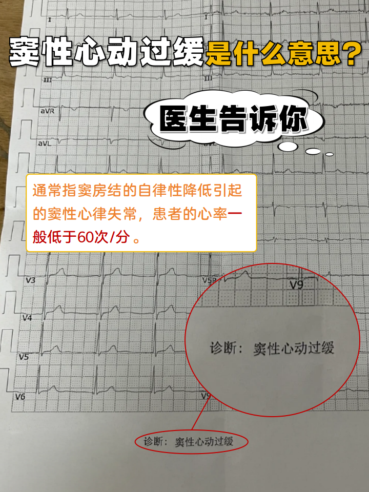 心脏性猝死怎么判断