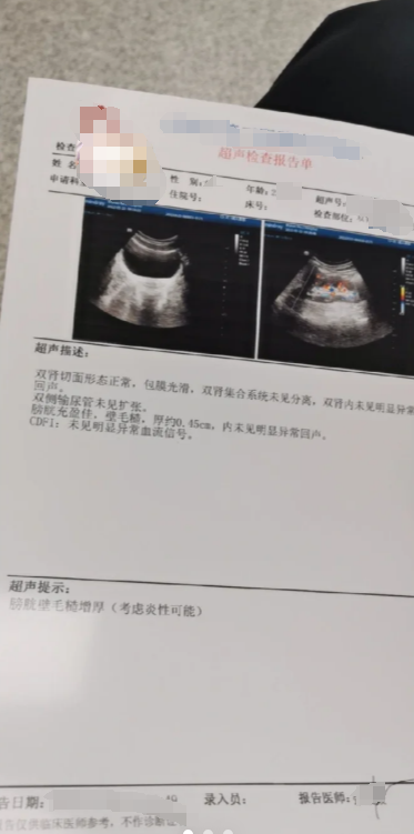 彩超能检查出前列腺炎吗?