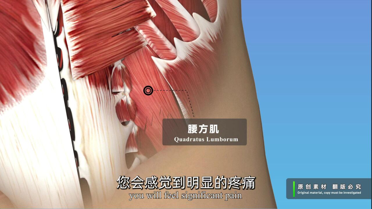 腰部肌肉拉伤了怎么办?