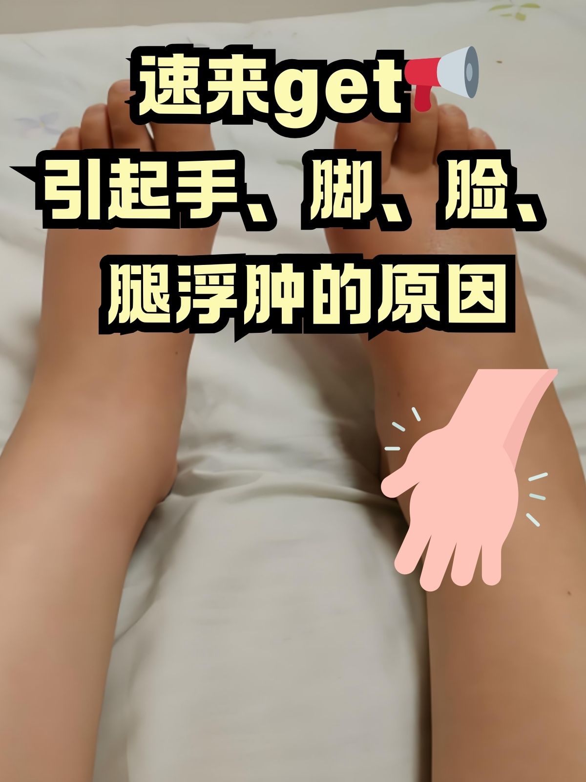 全身浮肿什么原因
