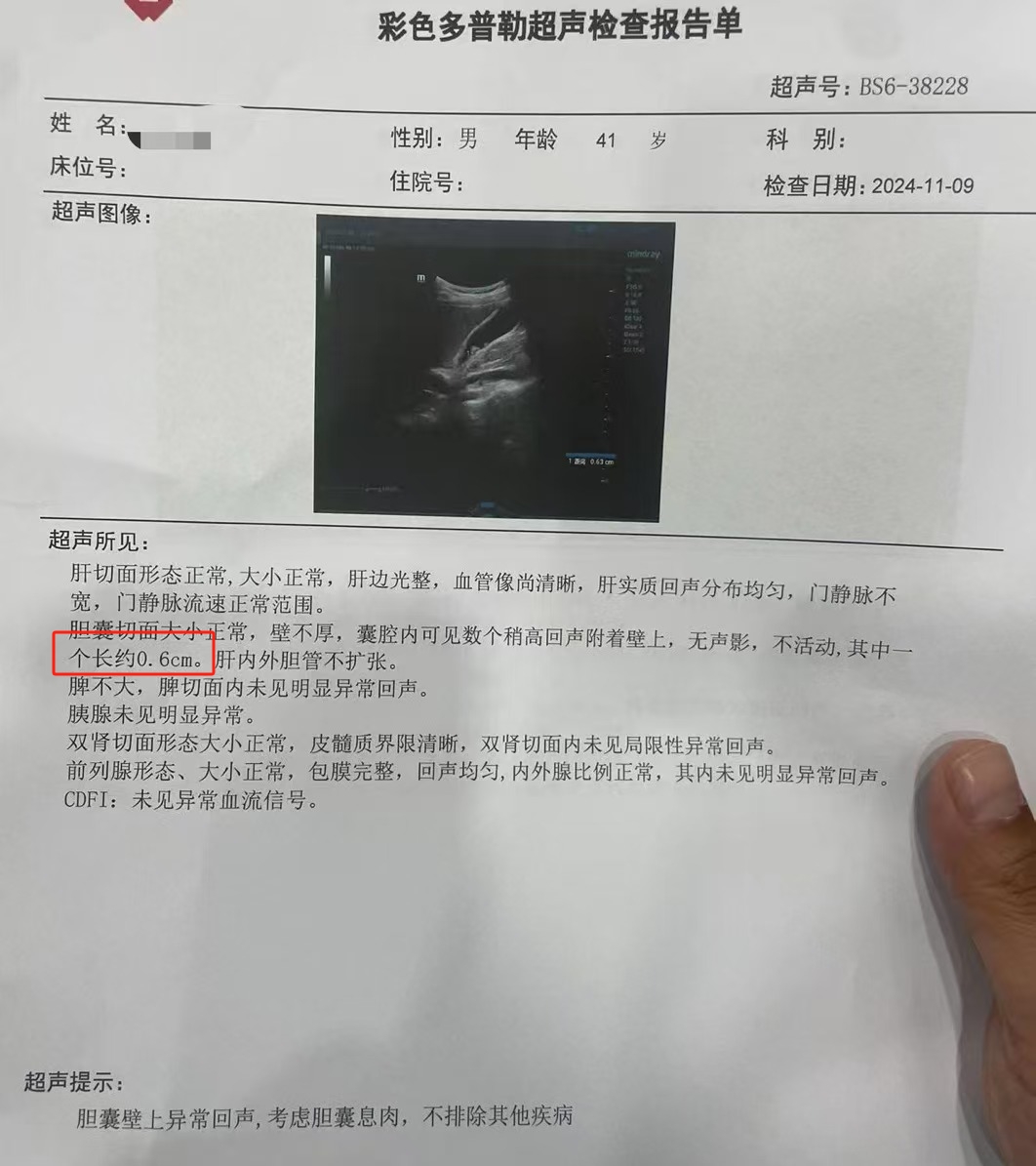 胆囊息肉多大需要手术