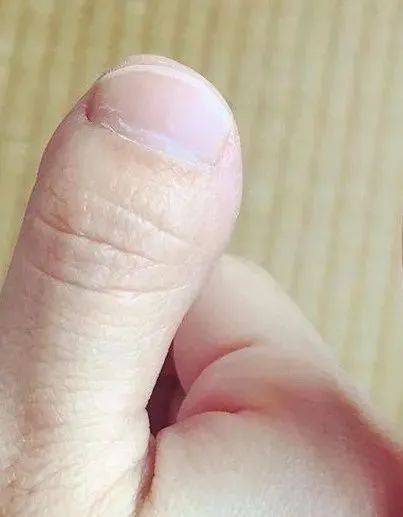 大拇指短而粗,并且指甲也比较短宽.
