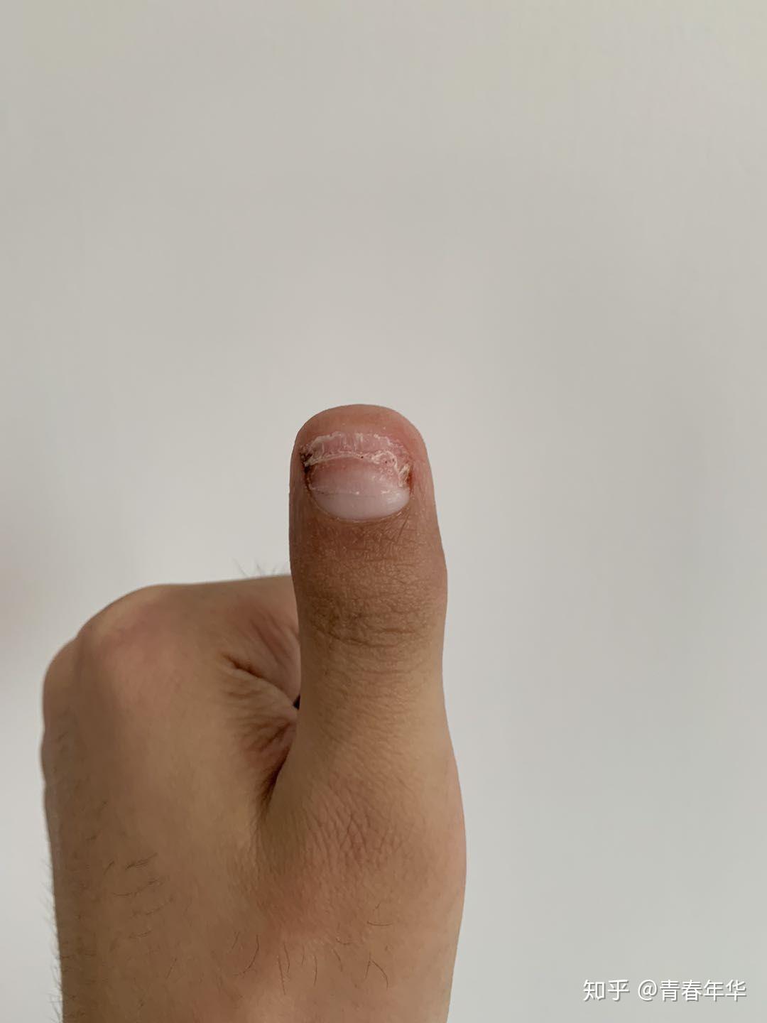 大拇指短而粗,并且指甲也比较短宽.