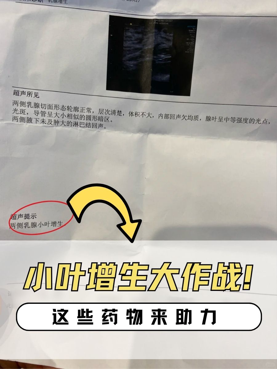 双侧乳腺小叶增生严重吗