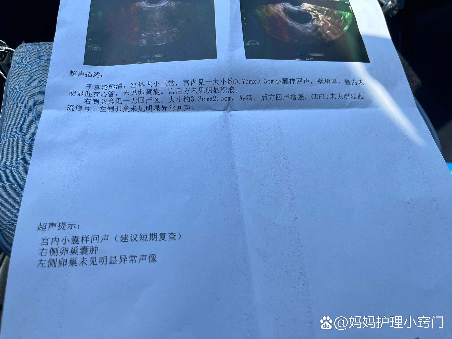 阴超能查出宫颈糜烂吗