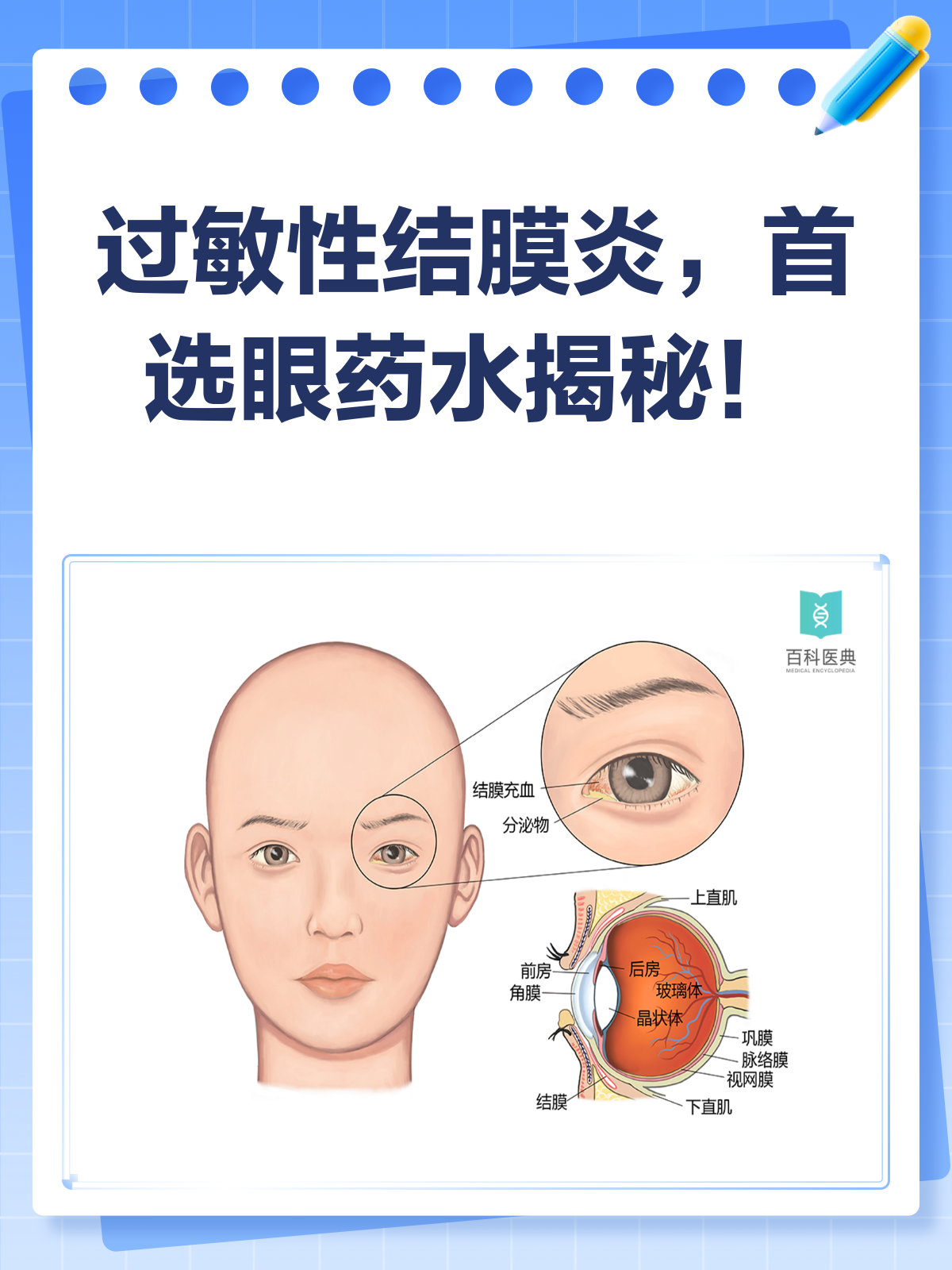 小孩得了结膜炎该怎么办