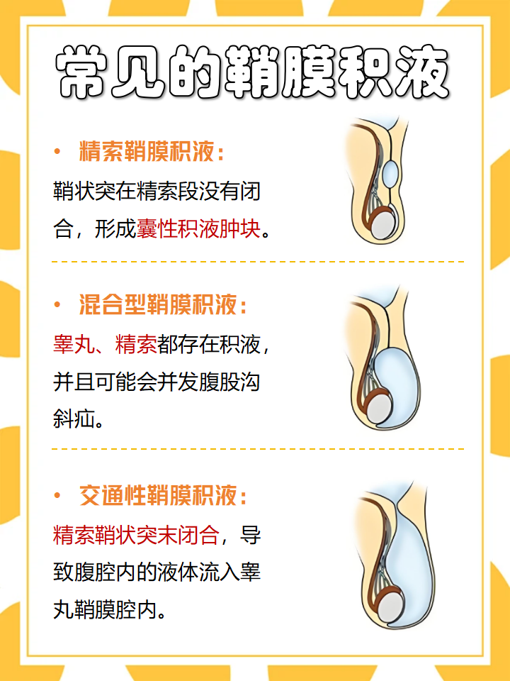 睾丸变小怎么回事..