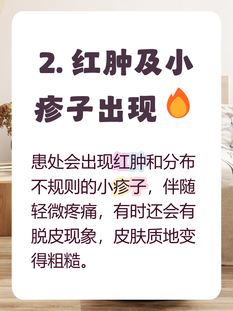 男性有霉菌感染的症状