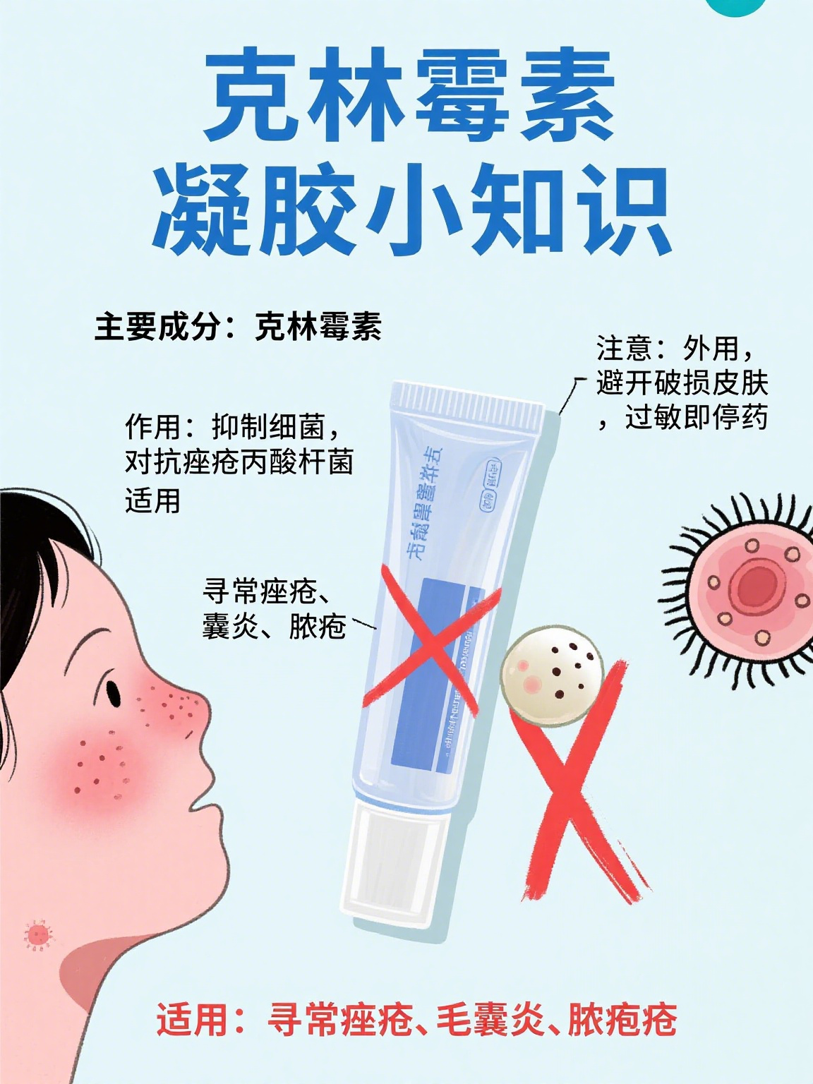 克林霉素属于哪类抗生素