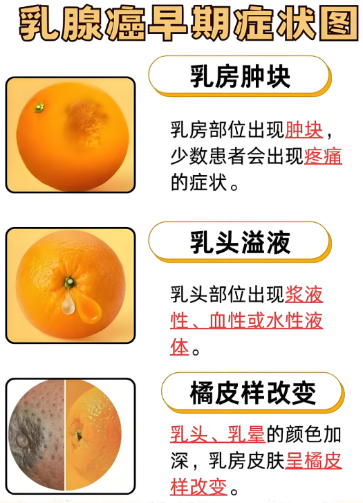 乳腺癌是怎么得的