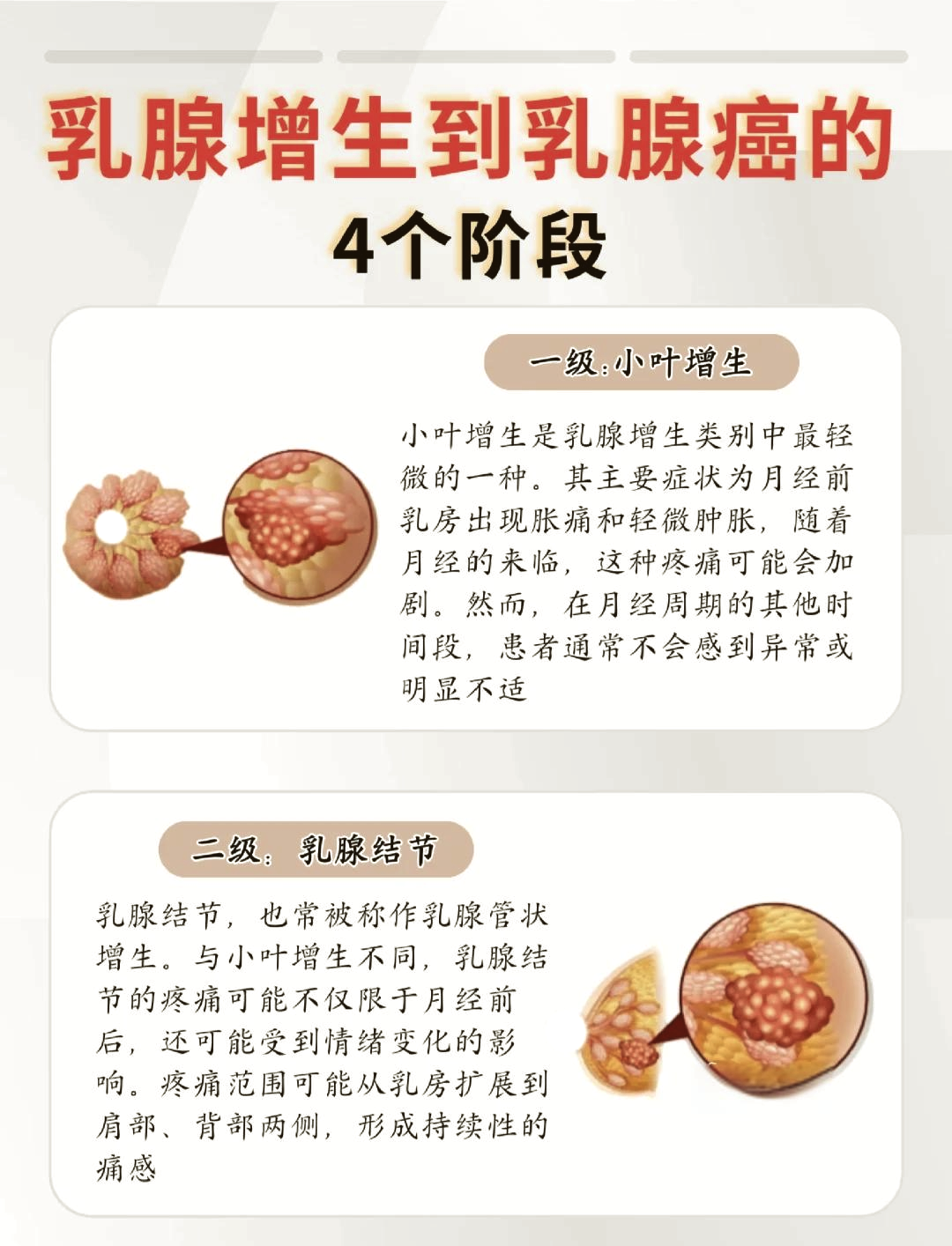 乳腺癌是什么样子