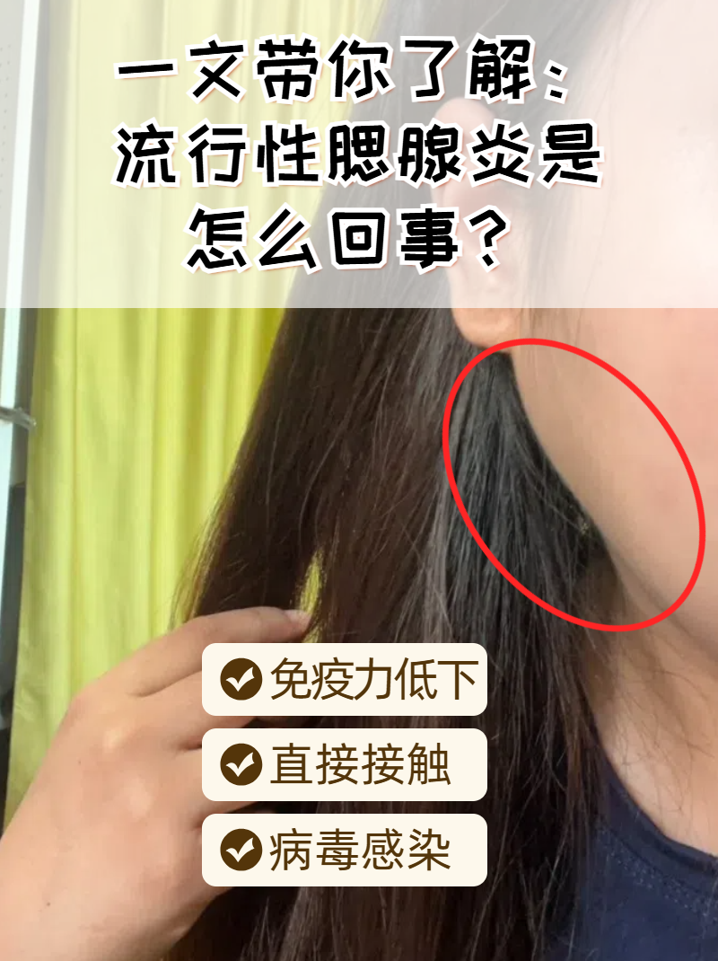 腮腺炎怎样传染的