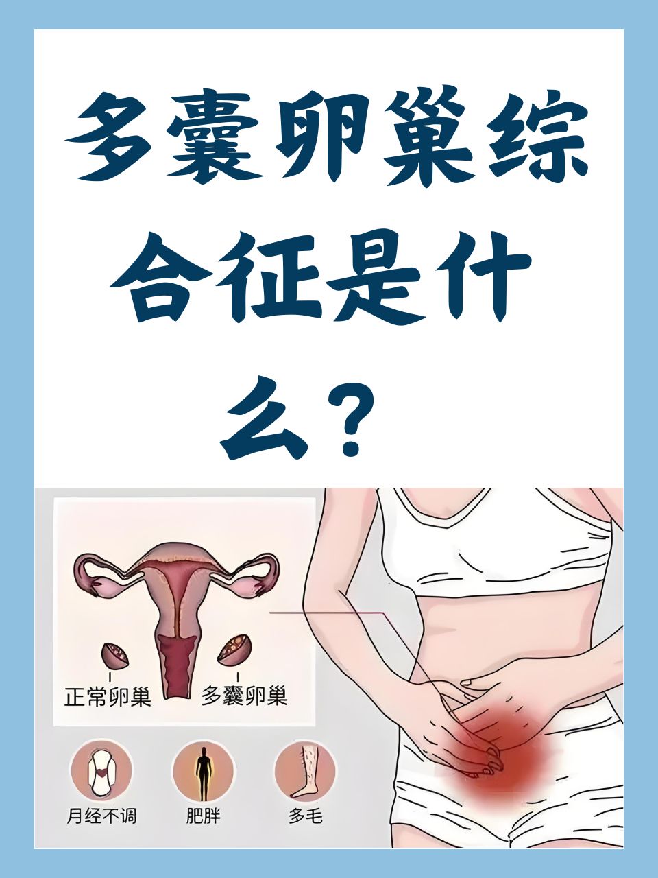 多囊性卵巢综合征症状是什么
