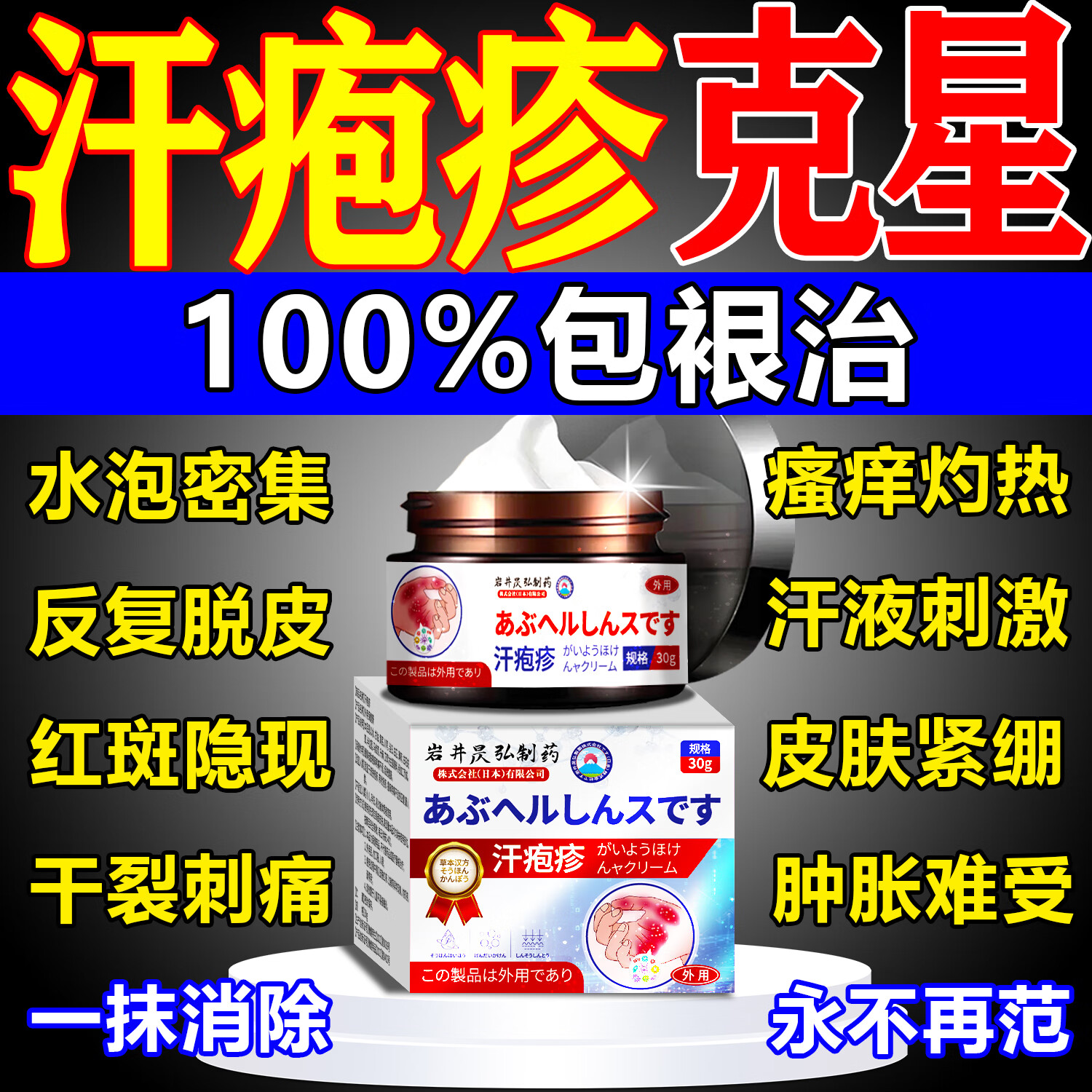 治疗汗疱疹的最好药膏有哪些