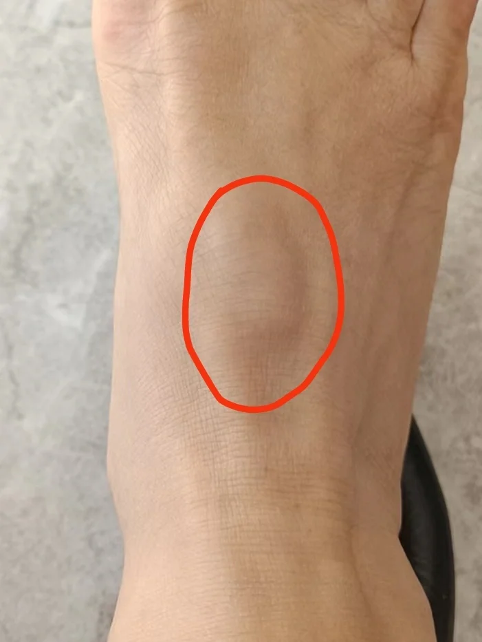 脚背疼是痛风吗