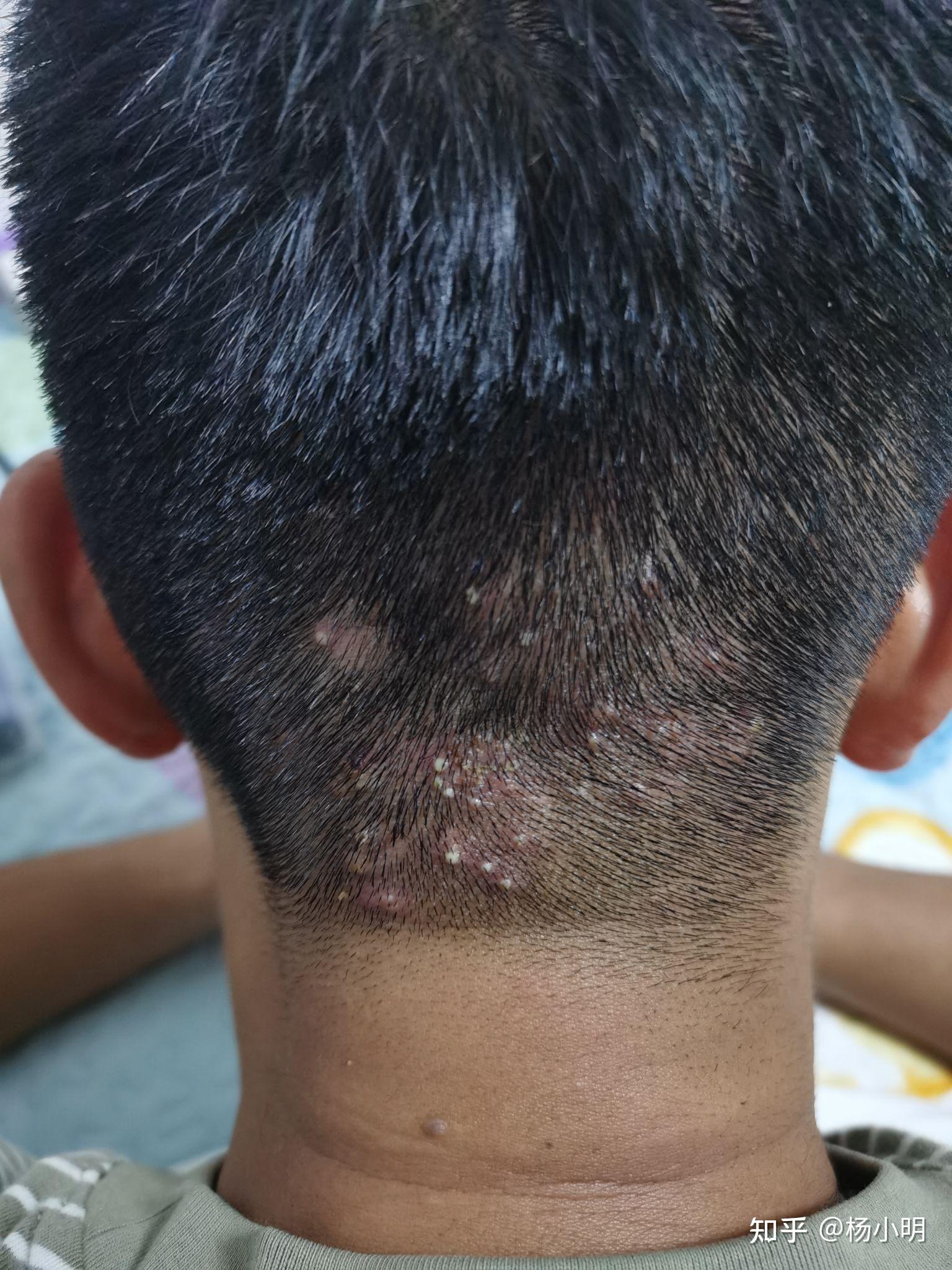 头部后面有一个大疙瘩