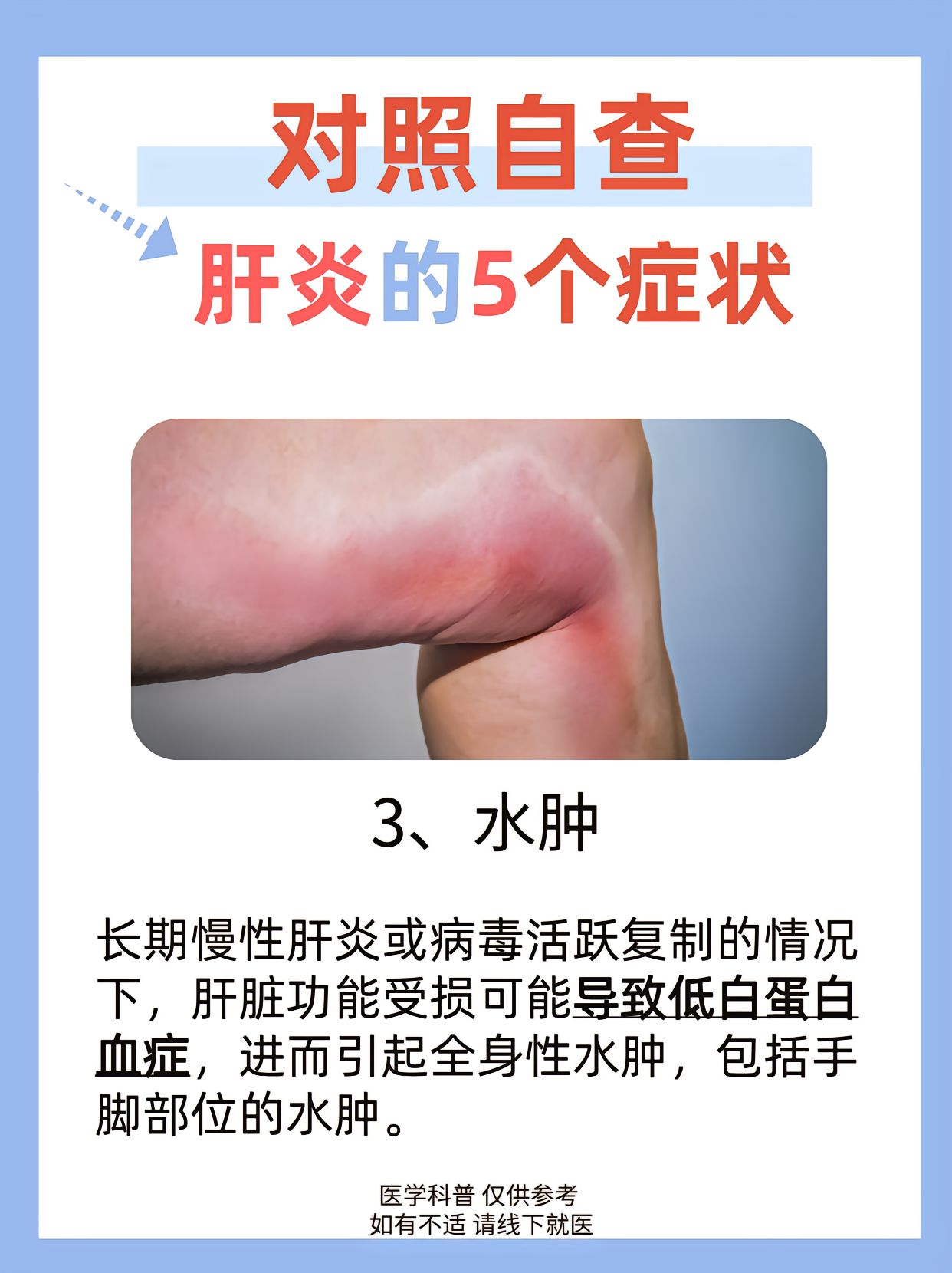 肝炎潜伏期能查出来吗