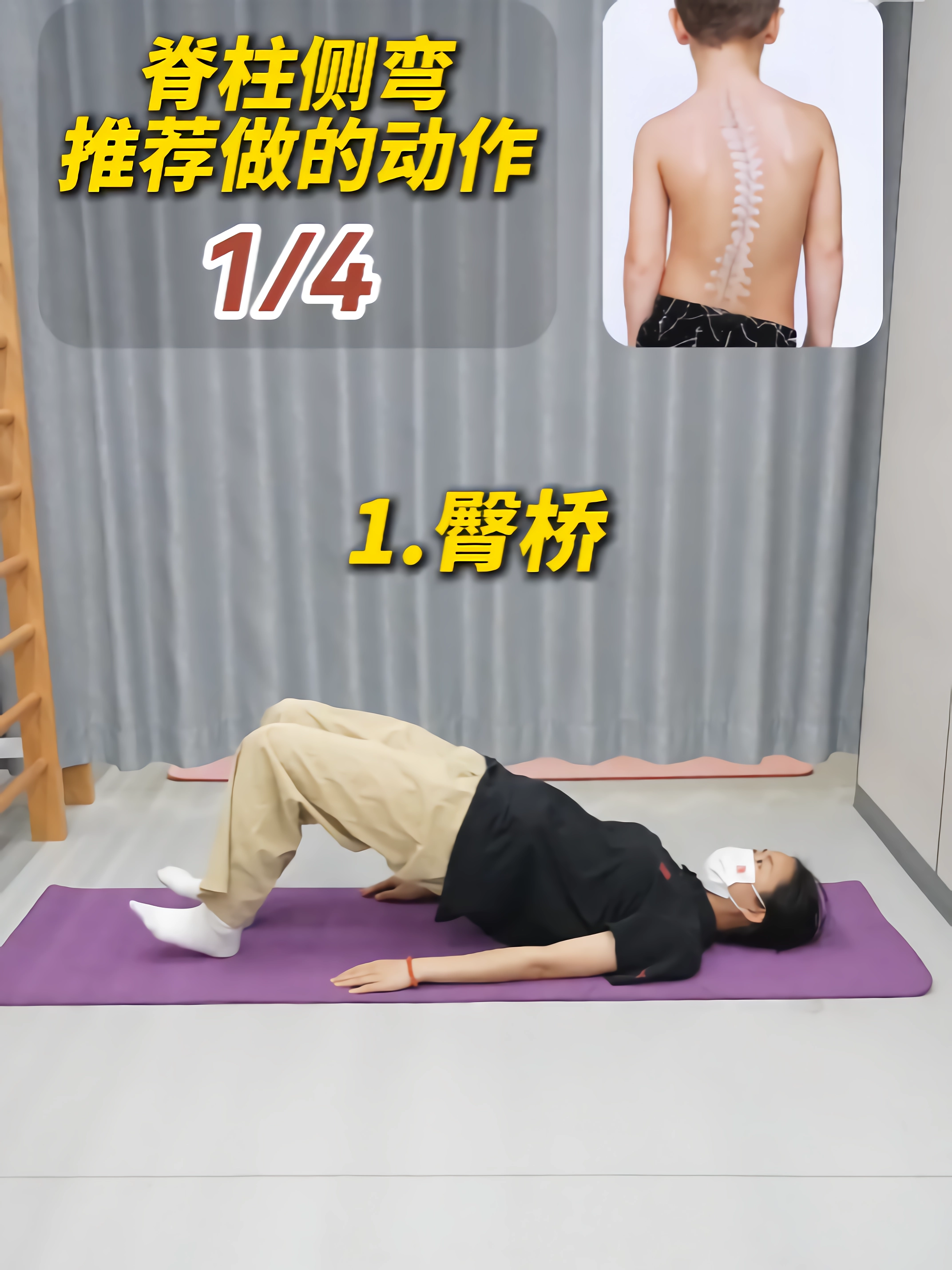 脊柱侧弯自我纠正方法是什么