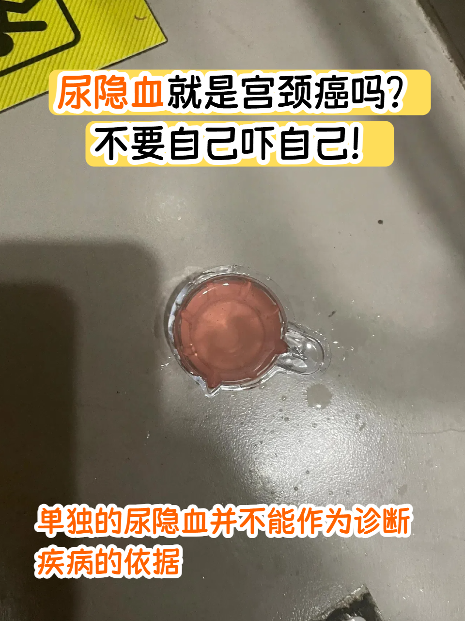 什么是尿隐血?