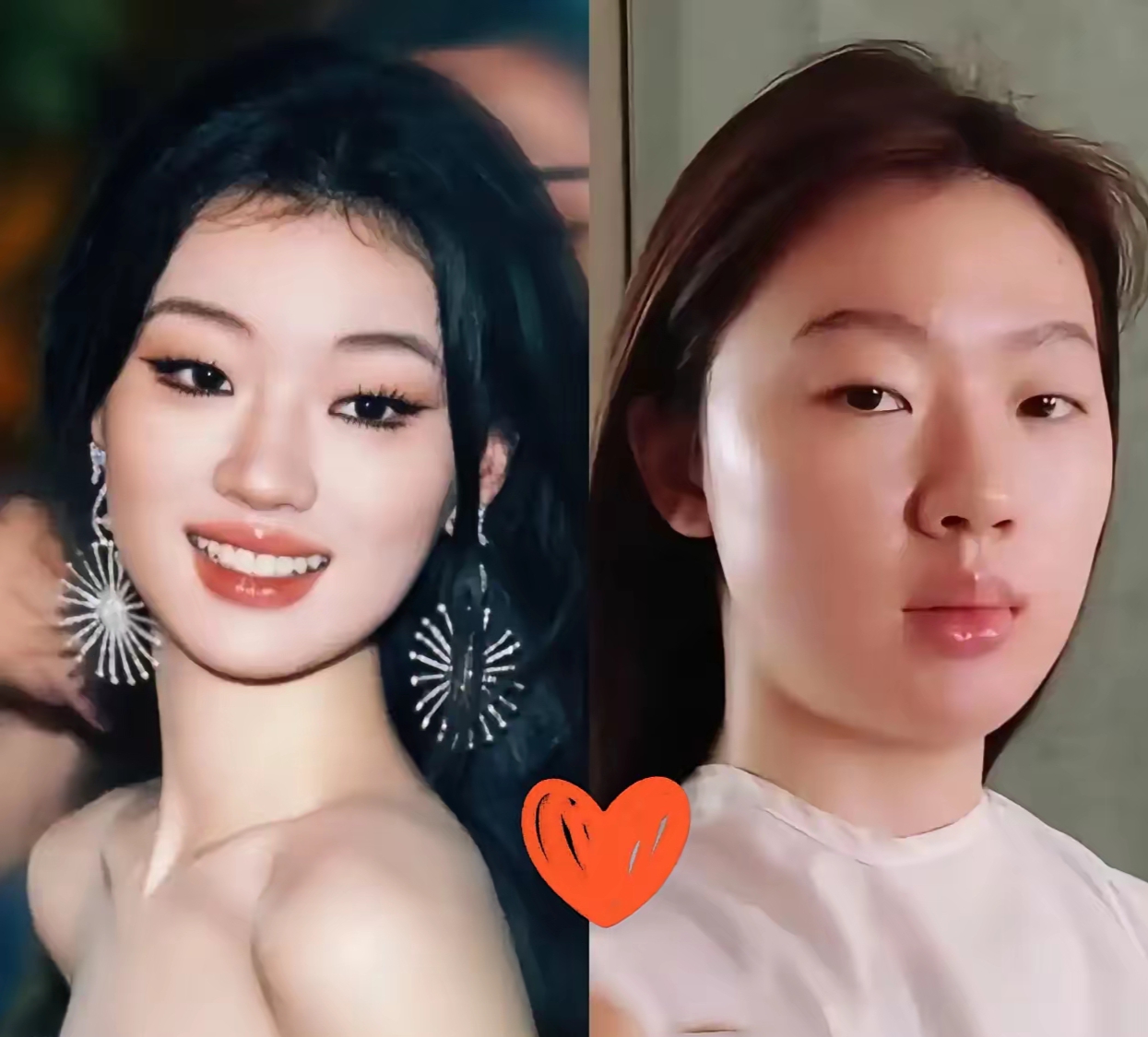 脸上浮肿怎么回事?